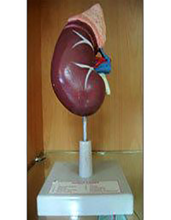 Human Kidney Model